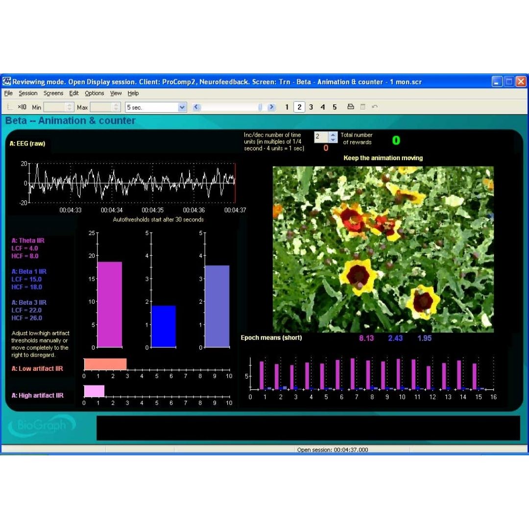 System EEG Biofeedback Infiniti 2 MULTI - obrazek 7
